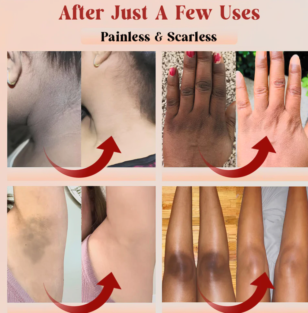 Lumora™ Exfoliating Gel